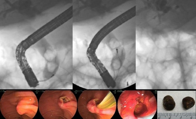 CPRE-FL_Syll_3.0적중율 높은 시험덤프자료 | C2Shub